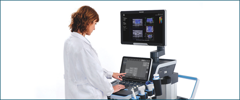 Ultrasound Imaging